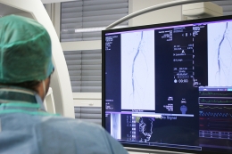 Radiologie v Městské nemocnici začala používat novou metodu ke zprůchodnění masivně kalcifikovaných tepen