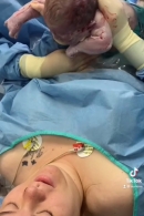 Euforie, líčí rodičky po jiném císařském řezu v MNO