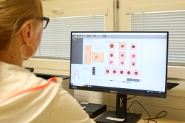 Nový digitální dermatoskop k diagnostice znamének