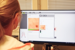 Nový digitální dermatoskop k diagnostice znamének