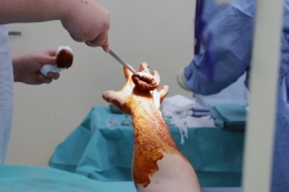 Den pro sestry - Neurochirurgie 2024