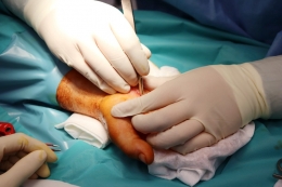 Den pro sestry - Neurochirurgie 2024